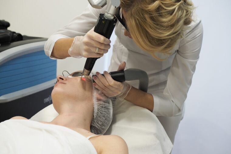 Laser procedure for skin rejuvenation