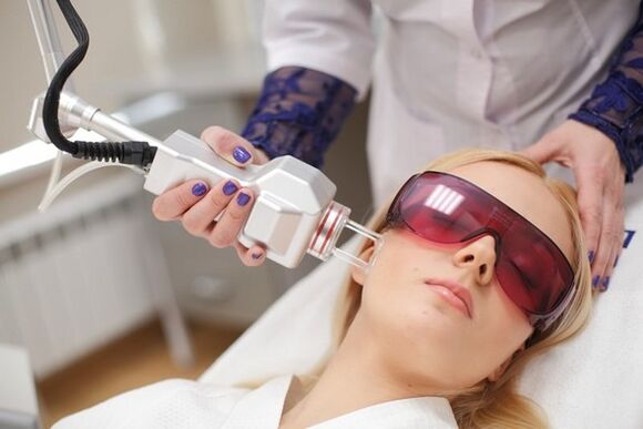 Laser rejuvenation of the face