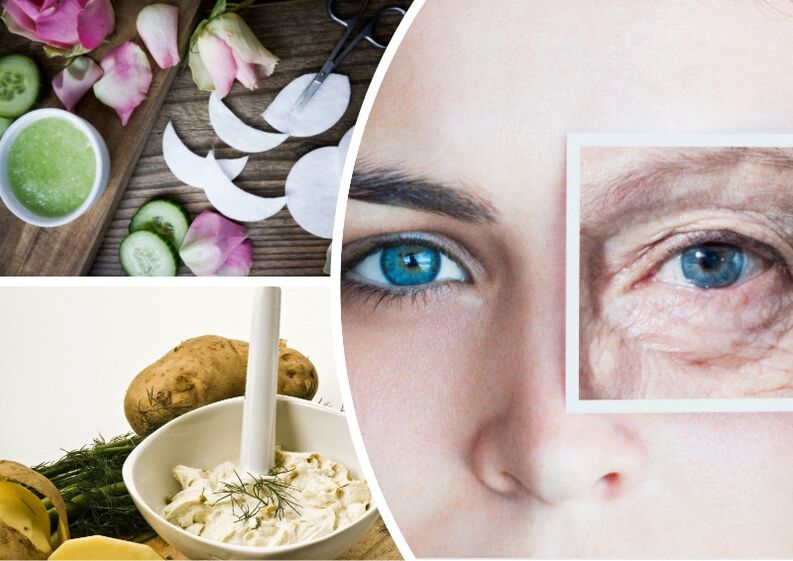 Skin run around the eyes