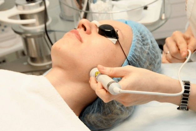 Laser bioretization