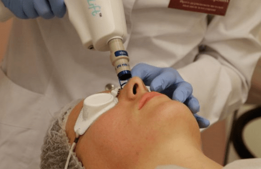 Non -resolved laser rejuvenation