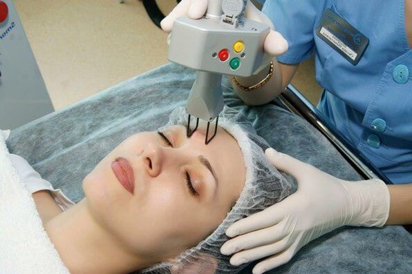 Laser rejuvenation