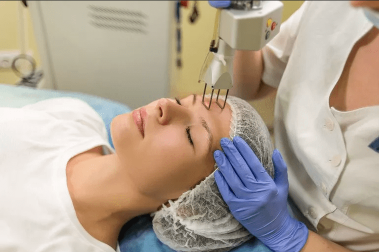 Laser facial rejuvenation process