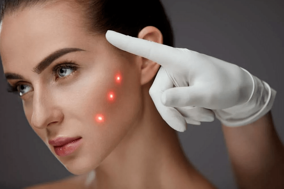 Rejuvenation methods