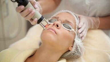 Types of fractional facial skin rejuvenation